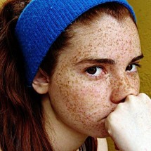 Girls with freckles — 51